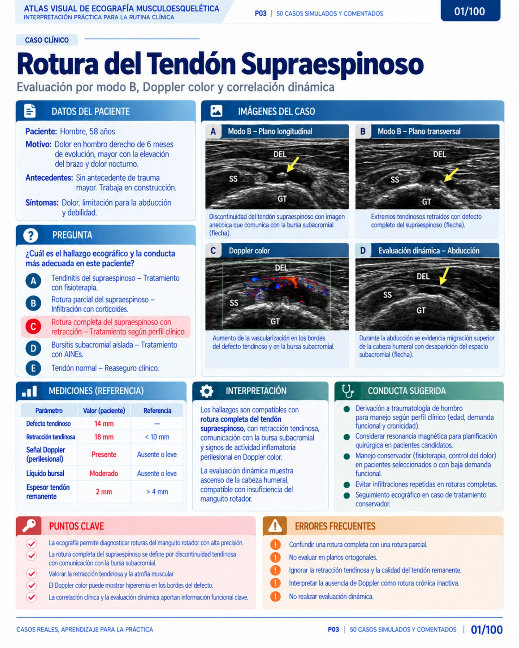 Página 1: Caso: tendón supraespinoso. Muestra del material educativo de ecografía musculoesquelética.