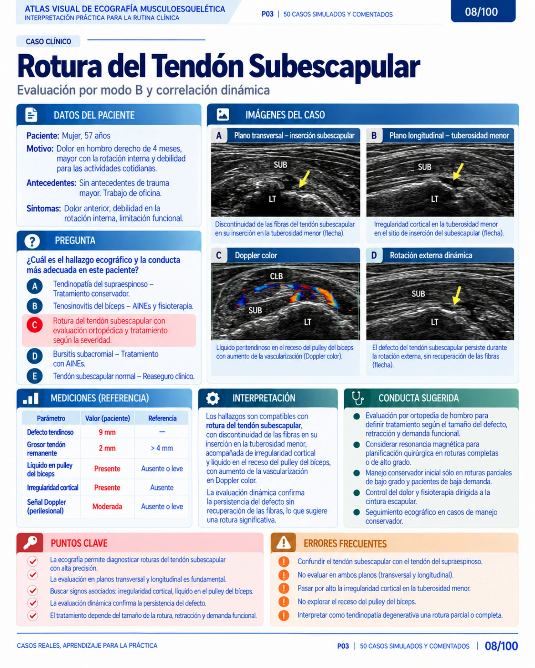 Página 8: Caso: tendón subescapular. Muestra del material educativo de ecografía musculoesquelética.