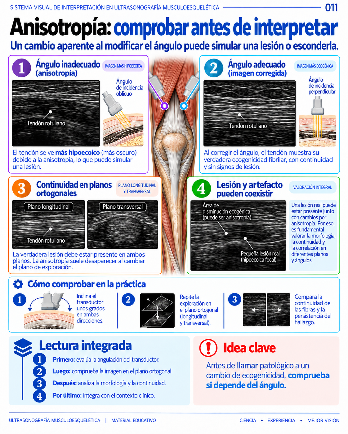 Página 11: Anisotropía: comprobar antes de interpretar. Muestra del material educativo de ecografía musculoesquelética.